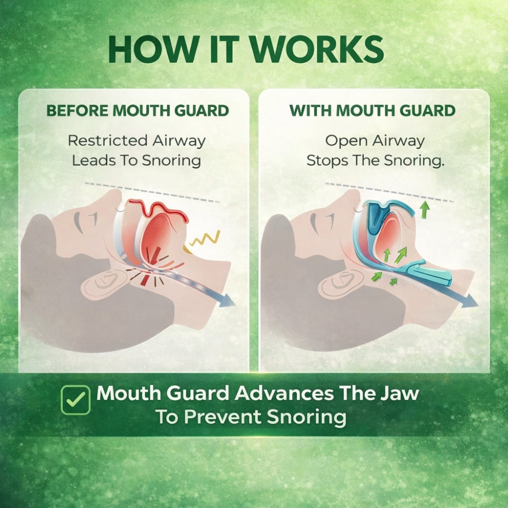 SnoreLess™ Anti-Snoring Mouthpiece