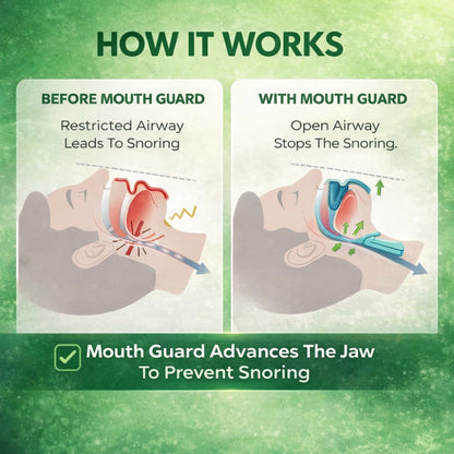 SnoreLess™ Anti-Snoring Mouthpiece